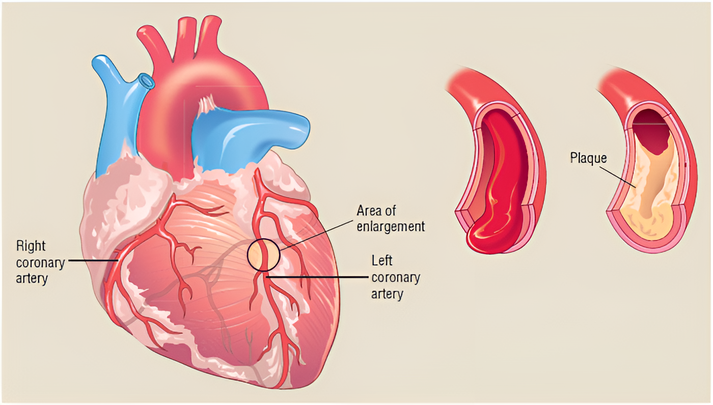 Heart Surgery Banner