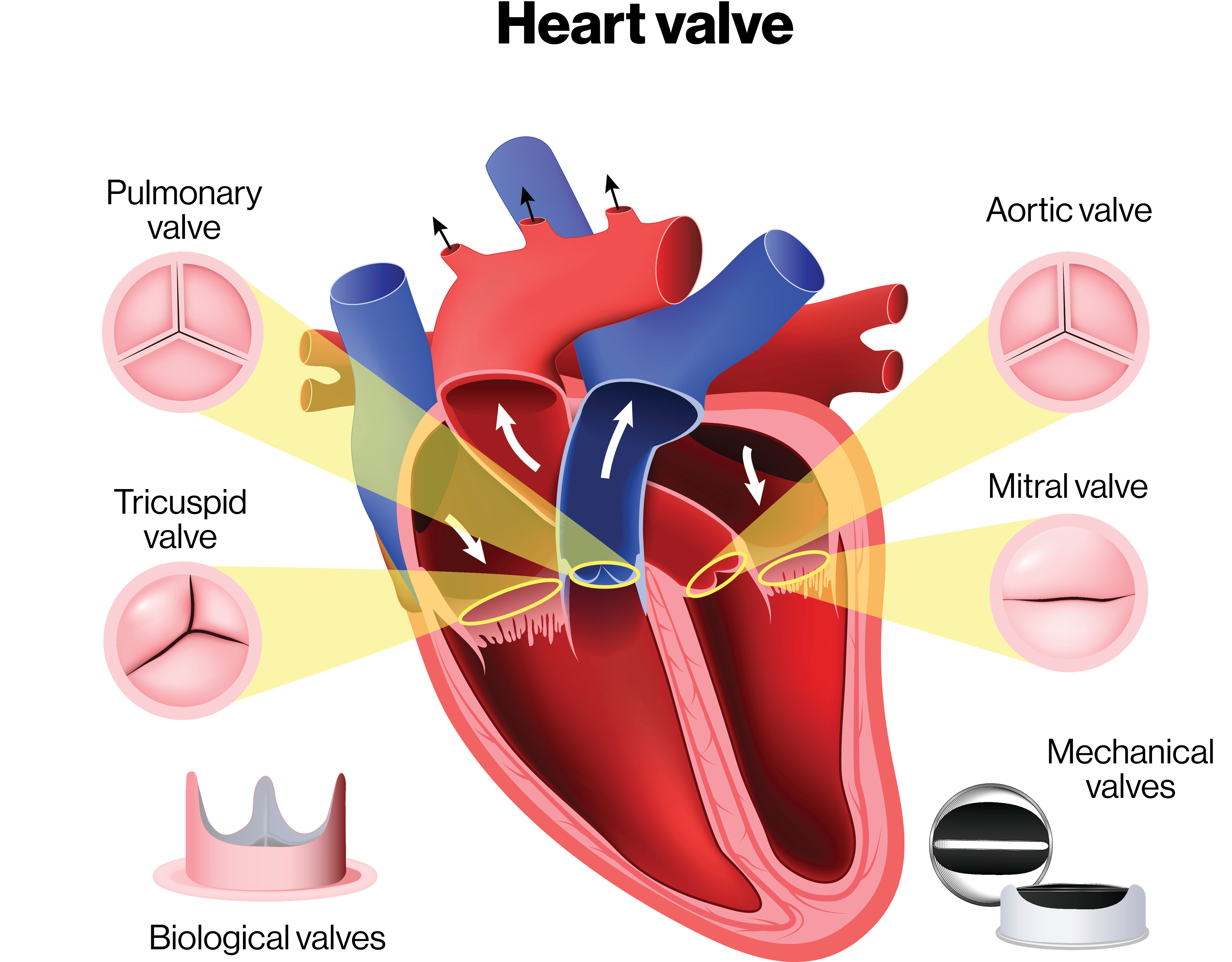 Heart Surgery Banner